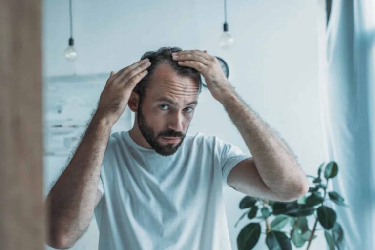 Τριχόπτωση: Ποιες είναι οι αιτίες και συμβουλές για την αντιμετώπιση