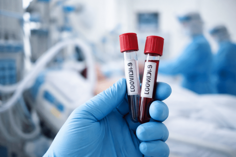 Covid-19: Τρεις θάνατοι την τελευταία εβδομάδα – Υποχωρούν οι δείκτες