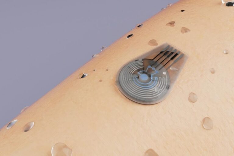 Το «έξυπνο» έμπλαστρο που αλλάζει την παρακολούθηση εγκυμοσύνης υψηλού κινδύνου