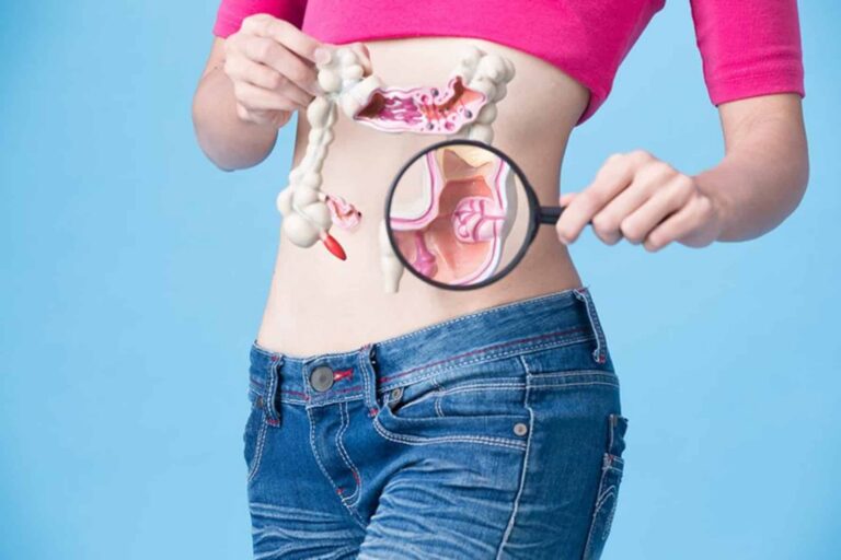 Πολύποδες εντέρου και καρκίνος: Πόσο χρόνο χρειάζεται η εξέλιξη και τι πρέπει να γνωρίζετε