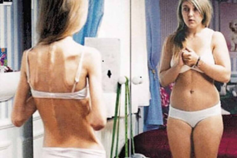 Ψυχογενής βουλιμία: Βιώνοντάς την σαν τη χειρότερη μορφή κακοποίησης